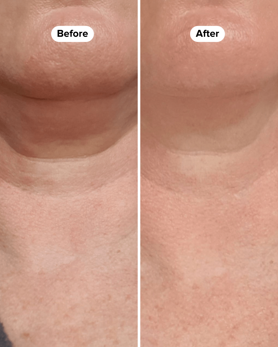 BOOST LAB Serum Neck Firming Serum