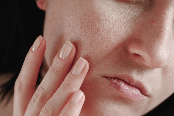 4 Simple Ways to Minimise Your Skin Pores