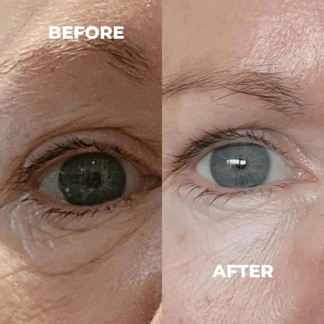 Before and after comparison of a person's eye texture improving after using Boost Lab products.