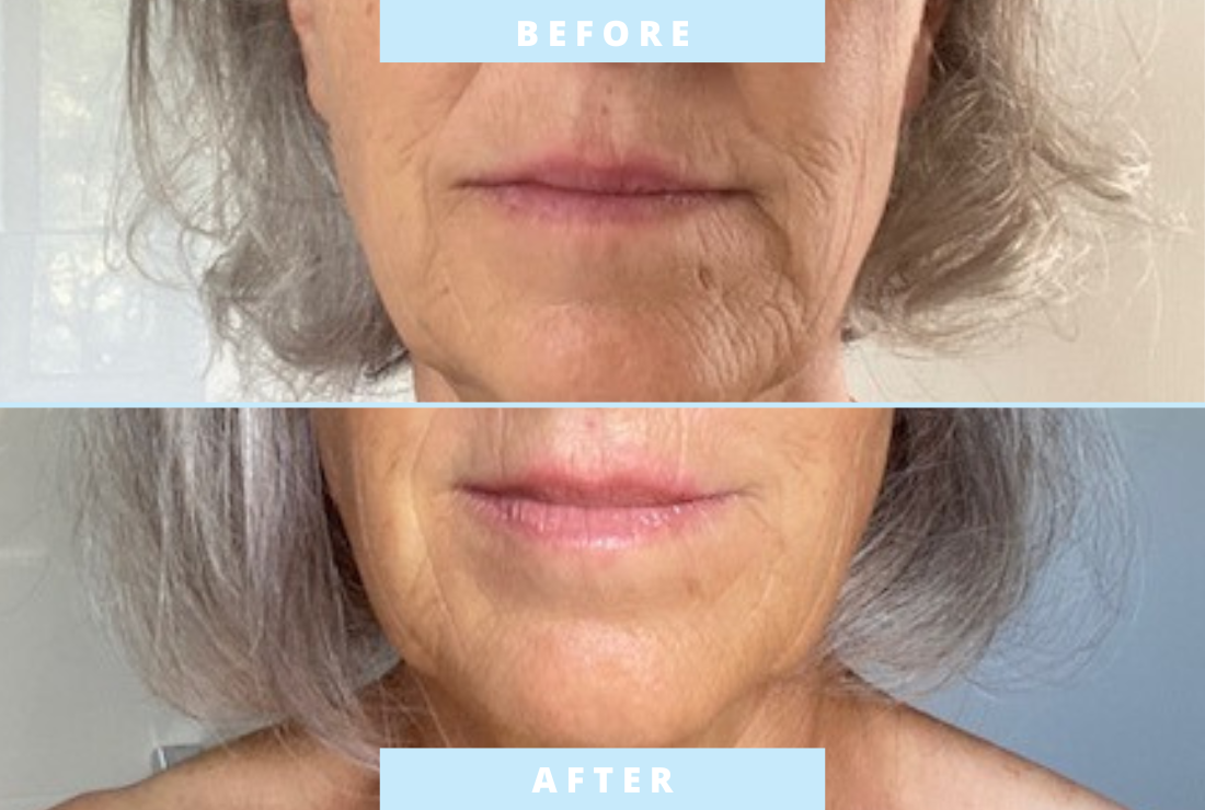 BOOST LAB | Affordable Clinically Proven Skincare