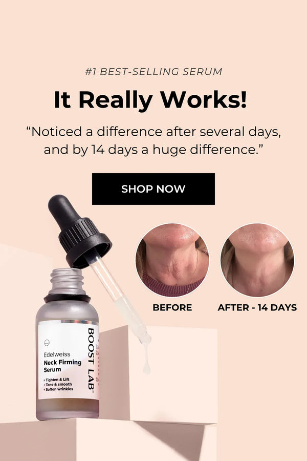 Edelweiss Neck Firming Serum with dropper on a beige background, showing before and after effects.