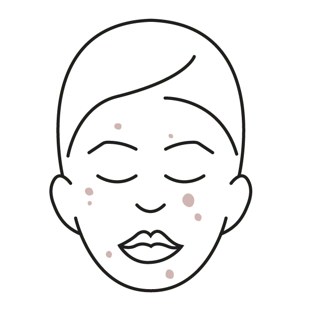 Outline of a face with with pink patches showing blemishes