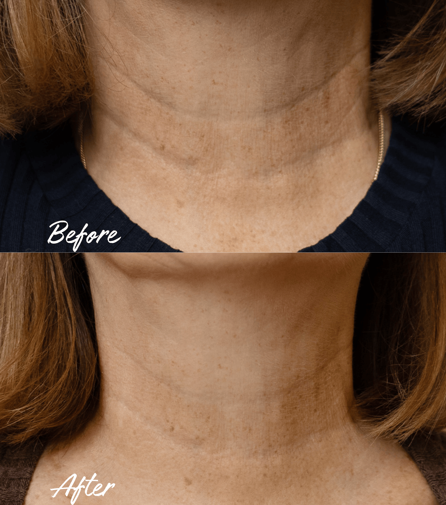 BOOST LAB Moisturiser Pro-Lift Neck & Décolletage Cream