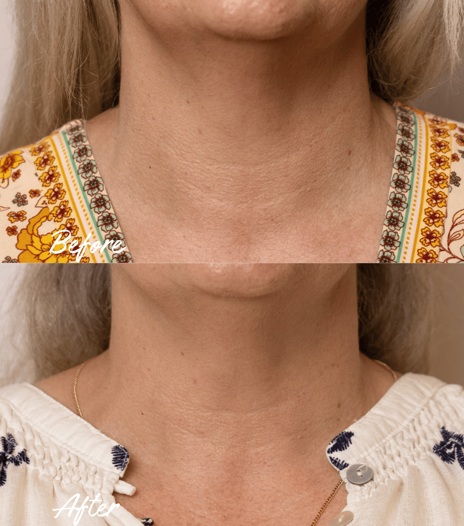 BOOST LAB Moisturiser Pro-Lift Neck & Décolletage Cream