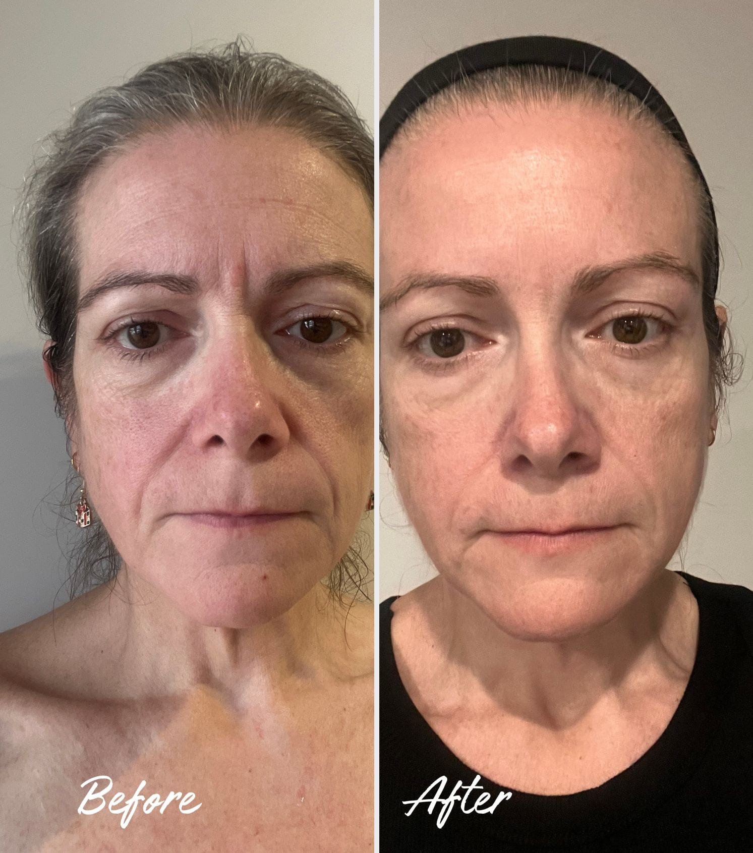 BOOST LAB Serum Collagen Firming Serum