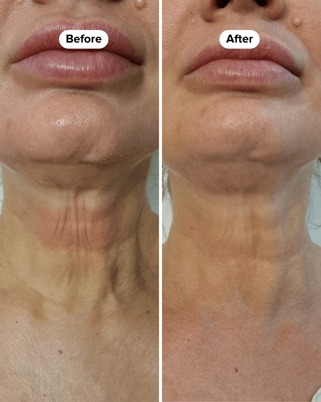 BOOST LAB Serum Neck Firming Serum