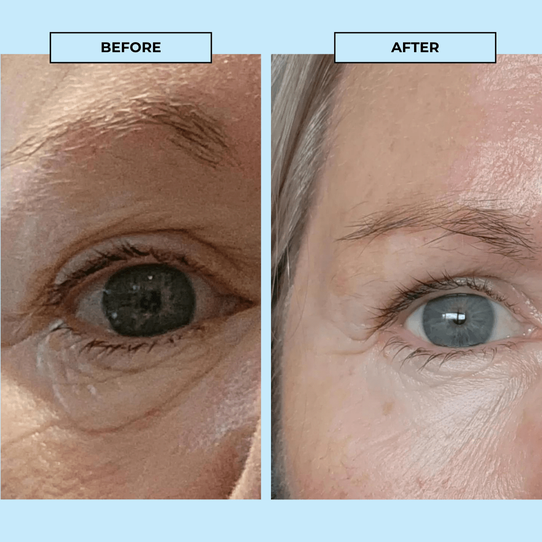 BOOST LAB Serum Eye Reset Serum